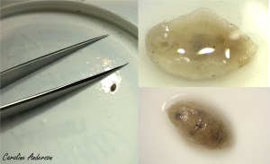 4. Gauche : la sangsue était très petite. Haut à droite : vue ventrale. Bas à droite : vue dorsale.